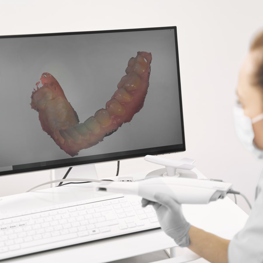 A dental professional looks at a computer monitor that features a 3D rendering of a patient's lower jaw.